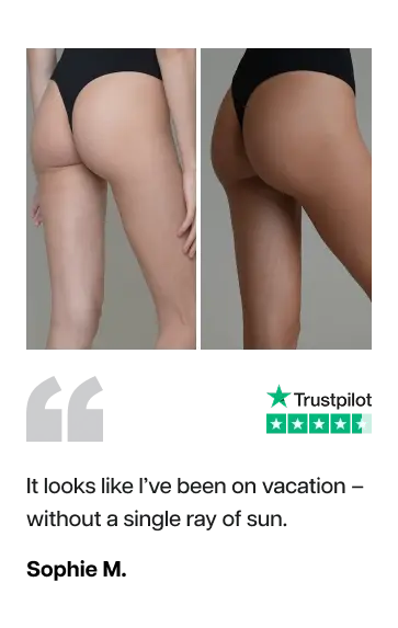 A side-by-side comparison of a woman's thighs and buttocks, showing a reduction in cellulite